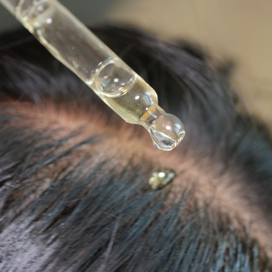Scalp Care
